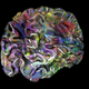 Illustration for article titled Heres the Exact Part of Your Brain That Thinks About Sex (And Cars, And Baseball…)